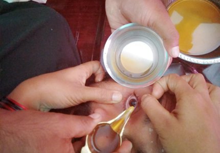 Kerala Ayurveda Panchakarma Cochi